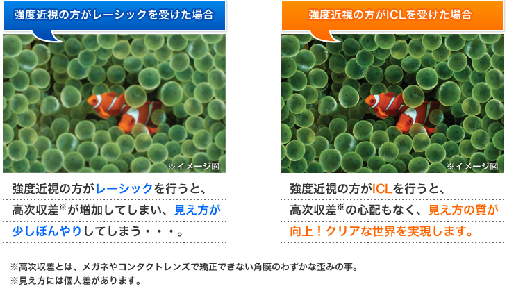 3か月で白内障 フェイキックicl 残念体験談集 Koで過矯正 Lasik術前術後に眼位検査とサイプレジンでの潜伏遠視の検査をしてほしい