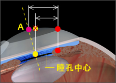 イメージ　正確な照射位置を瞬時に認識