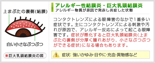 品川トリプルRスタンダードイントラレーシック