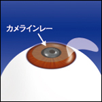 カムラインレーの設置