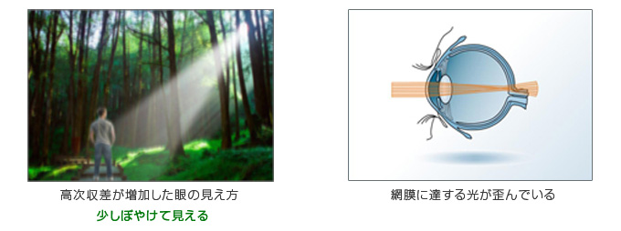 高次収差が増加した眼の見え方→少しぼやけて見える（網膜に達する光が歪んでいるから）