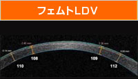 フェムトLDV