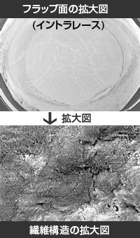 フラップ面の拡大図（イントラレース）