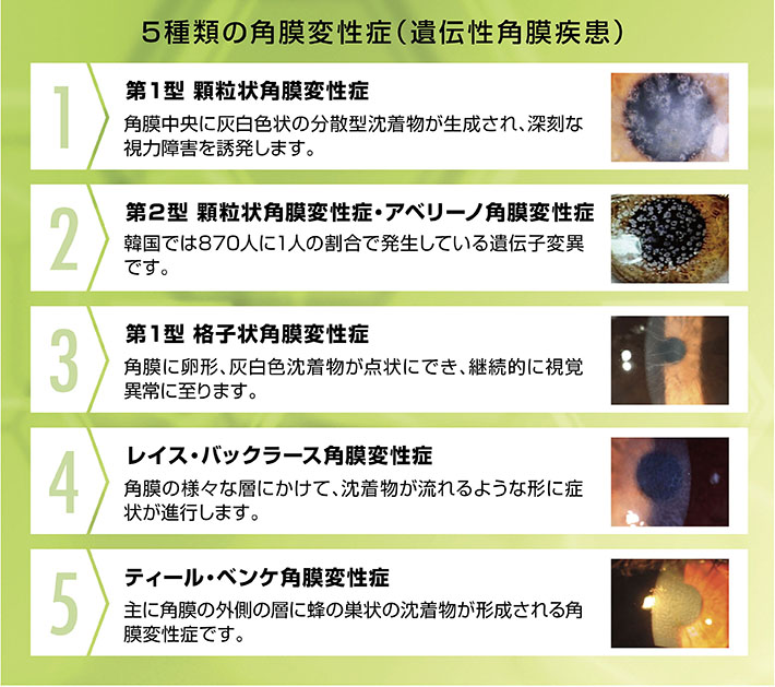 5種類の角膜変性症