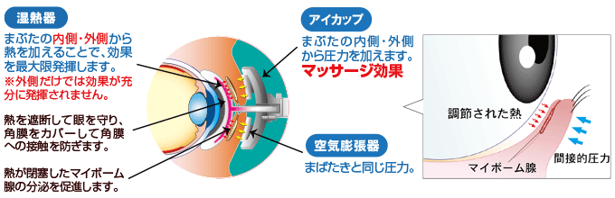 【湿熱器】まぶたの内側・外側から熱を加えることで、効果を最大限発揮します。【アイカップ】瞼の内側・外側から圧力を加えます。【空気膨張器】まばたきと同じ圧力