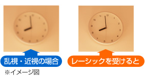 乱視・近視の場合ぼやけている。レーシックを受けるとはっきり見える。