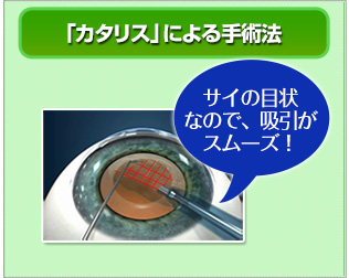 最新機器カタリスによる手術法