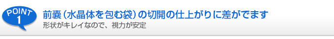 前嚢（水晶体を包む袋）の切開の仕上がりに差が出ます。形状がキレイなので、視力が安定