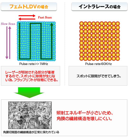 レーザーが照射される部分が重複するので、スポットに隙間が生じない為、フラップリフトが容易にできる→照射エネルギーが小さいため、角膜の繊維構造を壊しにくい！